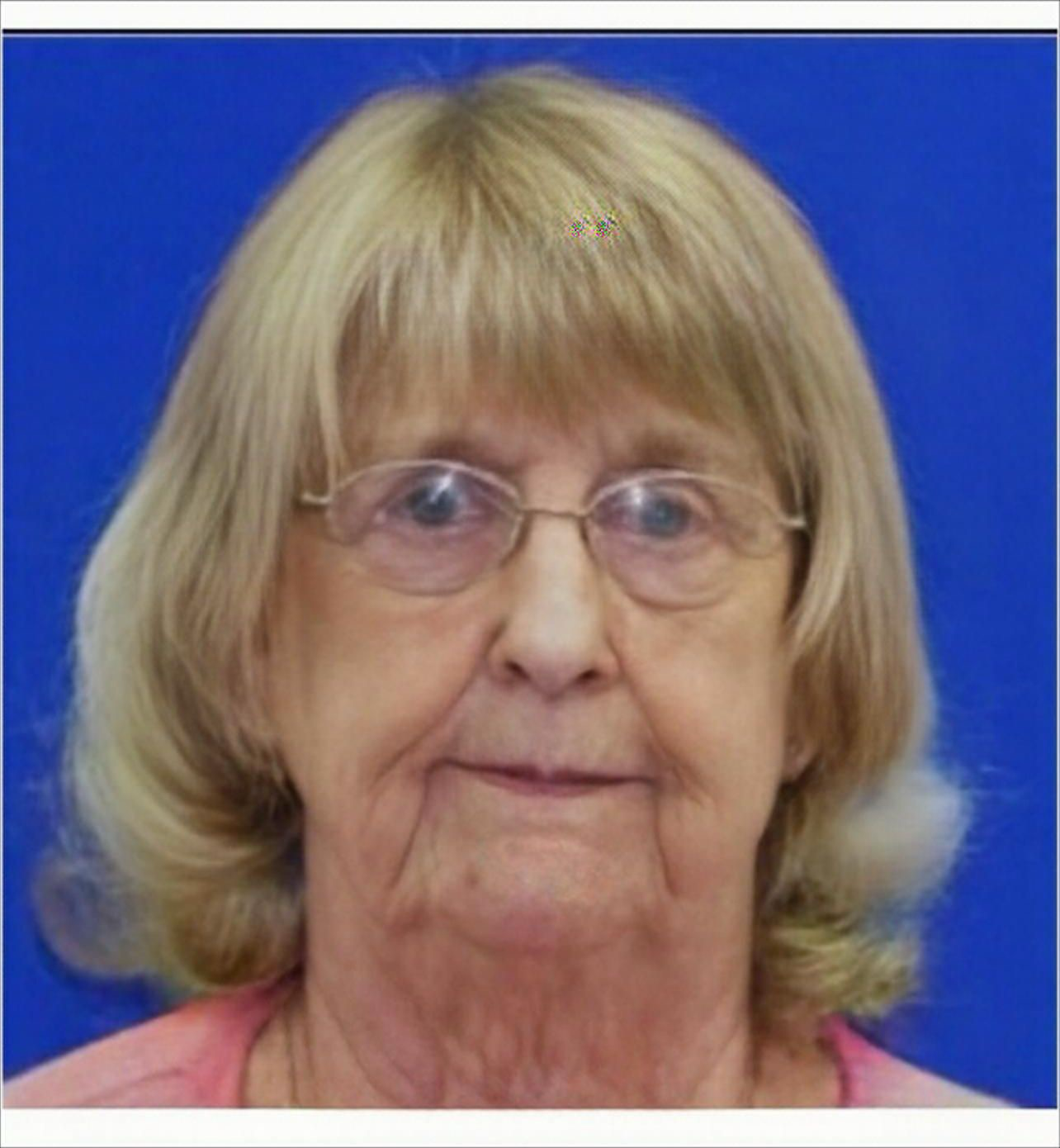 Age Progression Photo