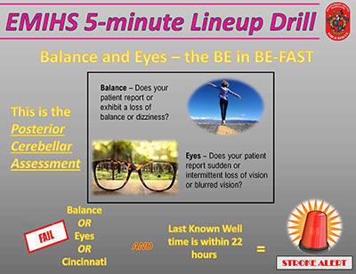 Thumbnail of Posterior Cerebellar Assessment document